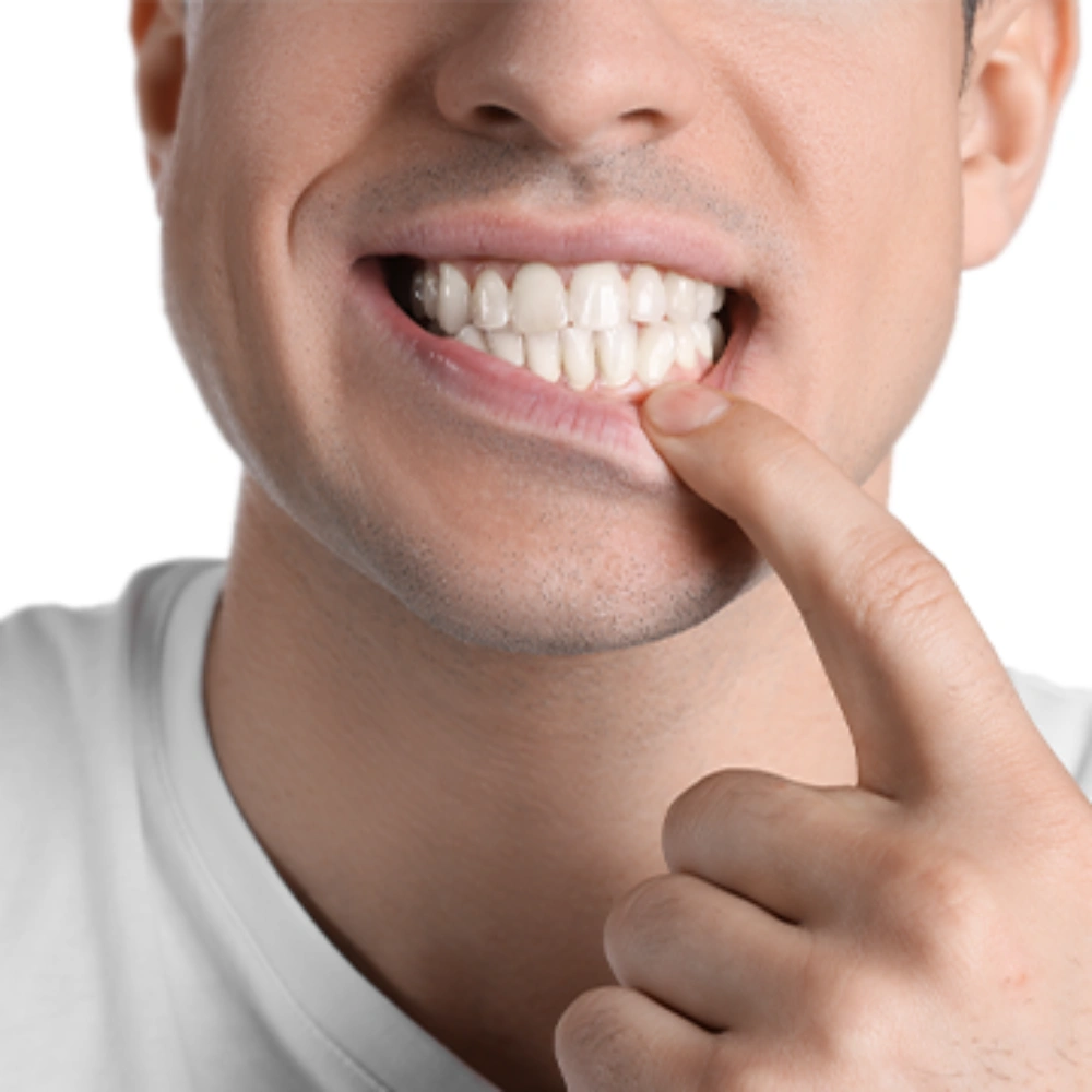 Diş Eti Çekilmesi Nedir ve Hangi Vitamin Eksikliğinden Kaynaklanır?